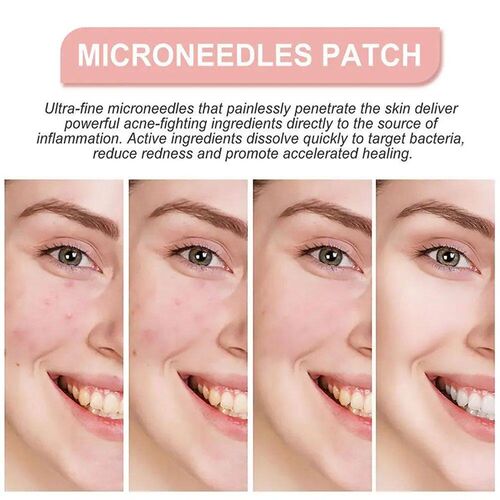 72pcs Patches Acne Pimple Patches Invisible Spots Marks Conc