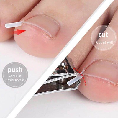 50Pcs Ingrown Toenail Correction Tool Ingrown Toe Nail Treat