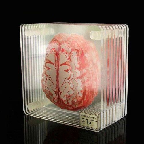Brain Specimen Coasters Set 3D Organ Brain Artwork Brain