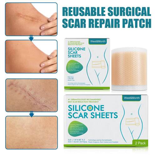 Hot 150CM Silicone Scar Sheets Skin Repair Patch Removal Sel