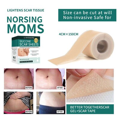 Scar Sheet Scar Silicone Strip Scar Tape Roll
