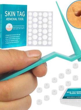 1set Micro Skin Tag Remover Rubber Band Wart Remove Acne Fac