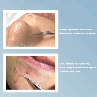 Acne Blackhead Removal Needles Black Dots Cleaner pimple rem