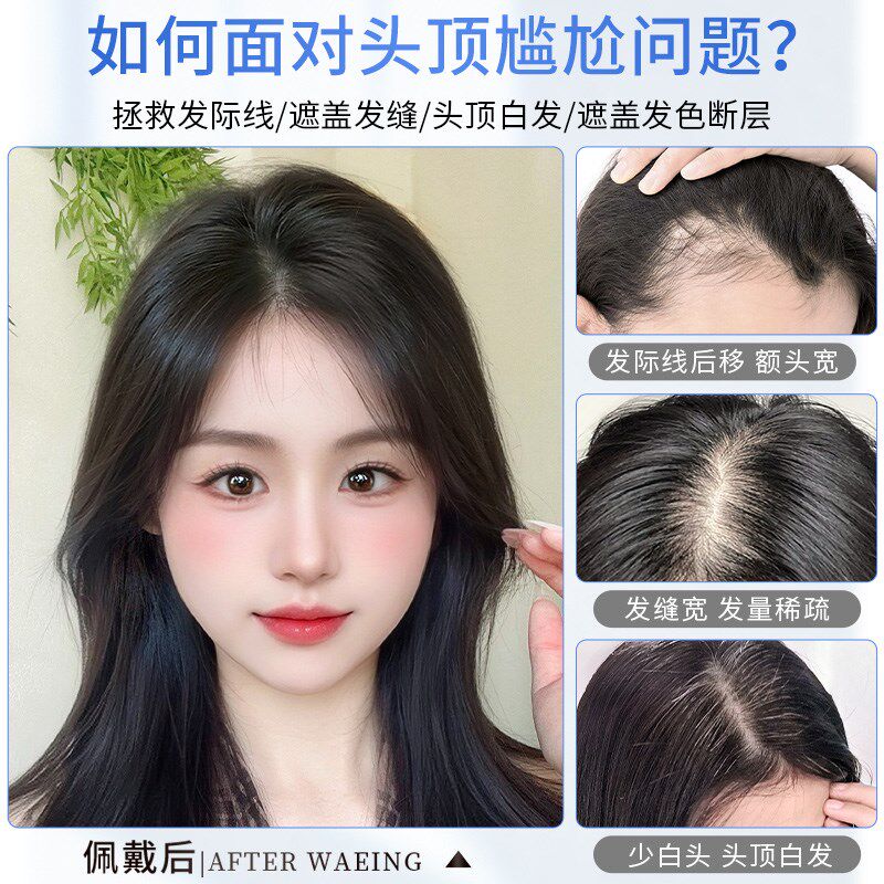 晚晚风胎毛遮盖后脑勺轻薄透全真人发头顶前额头顶补发刘海假发片