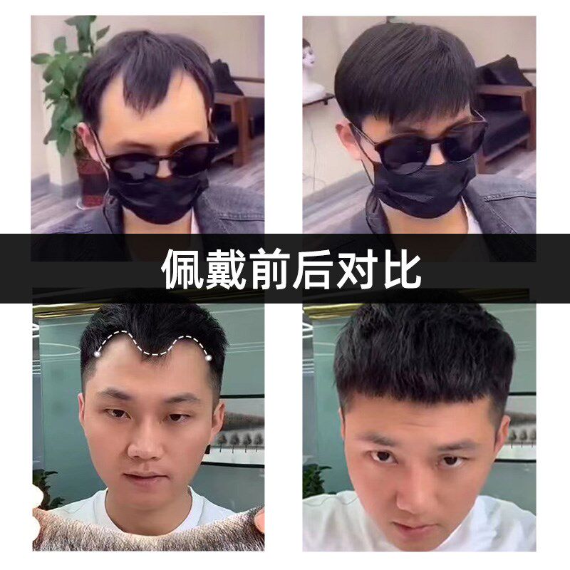 发际线假发贴男刘海假发片隐形无痕男士m型前额头全真发丝斜刘海