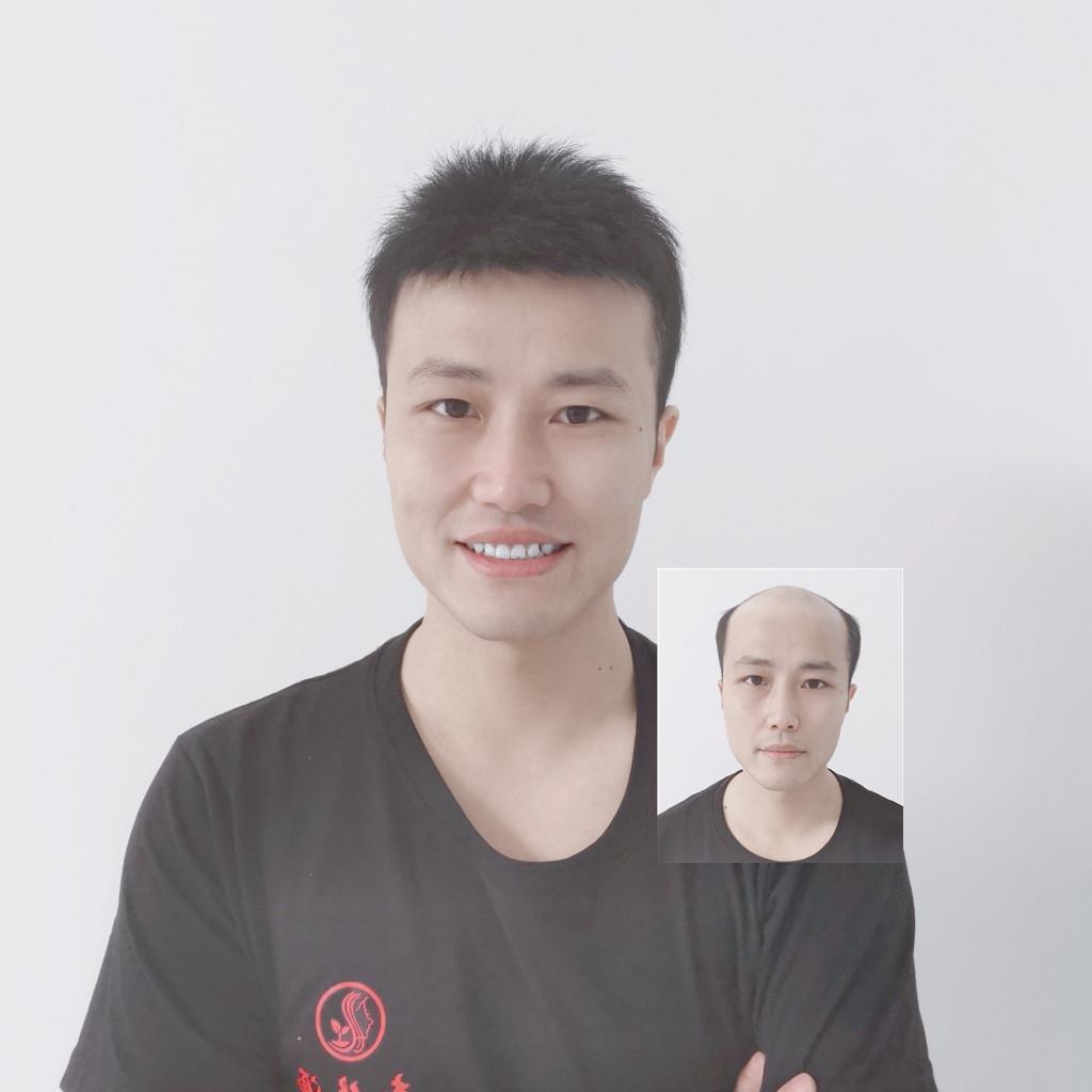 青丝源男士补发片 真人发丝前额遮盖假发 抖音翻盖头顶补发片可订