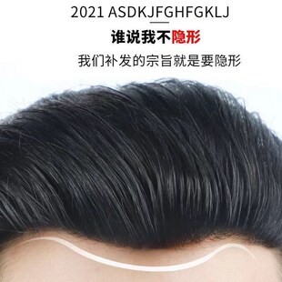 男发际线假发贴男士前额发际线真发贴片隐形M型发际线后移生物皮