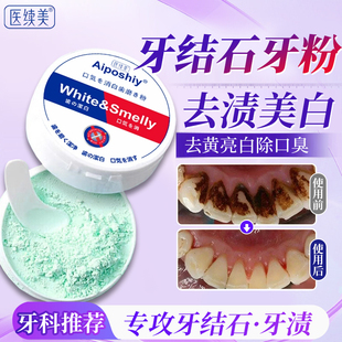 牙粉去牙结石美白去黄清洁污垢溶解牙石牙垢清除神器用速效清理DS