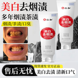 强力去烟渍牙膏去牙渍牙垢黄牙结石洗牙粉亮白牙齿清洗剂神器YZ