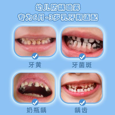儿童护齿口腔喷雾宝宝蛀牙益生菌口喷清新防口气婴儿牙齿清洁