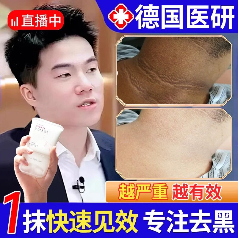 脖子黑色素去除黑棘皮脖子黑色素皮肤消毒护理（消）