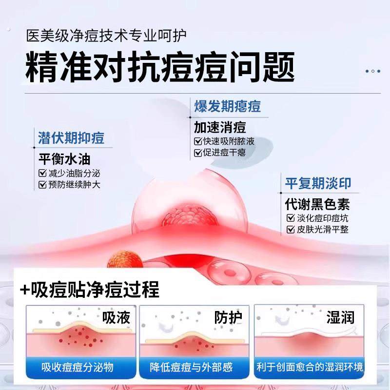 星星痘痘贴痘印贴人工皮水胶体敷料吸脓可上妆可爱豆豆遮瑕祛痘贴,美容护肤/美体/精油,面部痘痘贴,淘宝优惠券,粉丝福利购,淘宝优惠卷