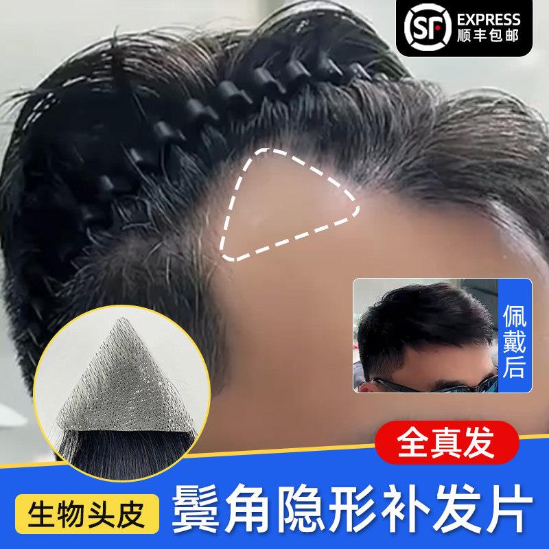男士假刘海片鬓角补发假发片男女全真人发m型前额发际线假发贴片