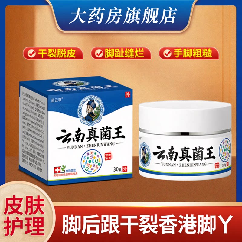 云南真菌王手脚脱皮开裂抑菌乳膏