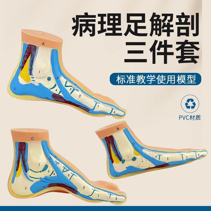 足部模型 人体脚掌肌肉模型弓形脚掌模型 脚解剖模型平板足正常足,文具电教/文化用品/商务用品,教学标本/模型,淘宝优惠券,粉丝福利购,淘宝优惠卷