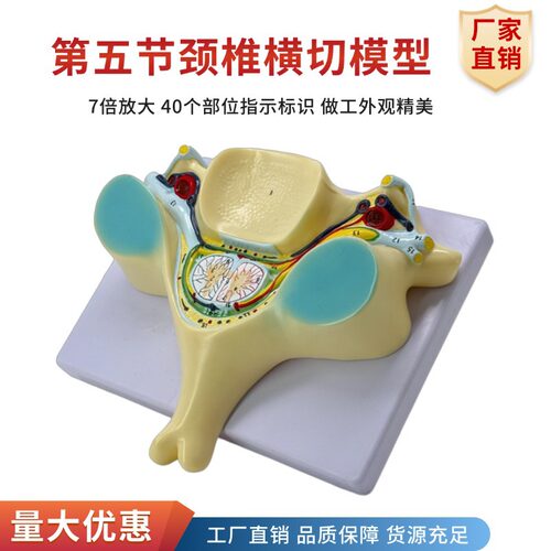 人体第五颈椎横断解剖颈椎神经脊髓放大模型 骨科疼痛科神经科