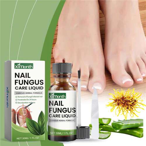 Nail Care Liquid Soften Ingrown Toenail Brightening 护甲液