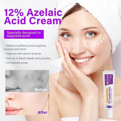 现货外贸Azelaic Acid 12%壬二酸精华烟酰胺软膏舒缓肌肤凝胶