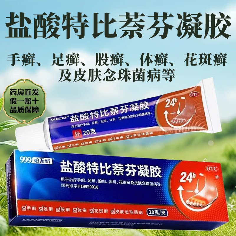 999必无忧盐酸特比萘芬凝胶2癣症