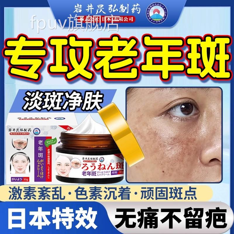 去老人斑专用膏除强力去除中药手部老年斑黑抹净老人斑一擦祛就掉