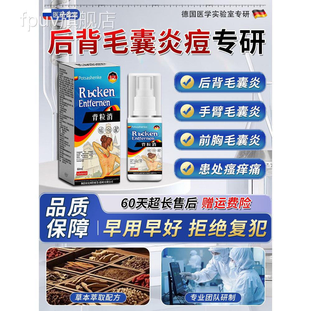 长马拉色菌前胸后背背后痘痘毛囊炎除螨祛痘痒手臂胳膊疙瘩喷雾剂