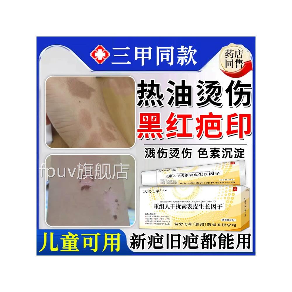 热油油烫伤伤去疤烧膏疤痕修复除疤膏儿童祛去红印黑印色素沉淀FP