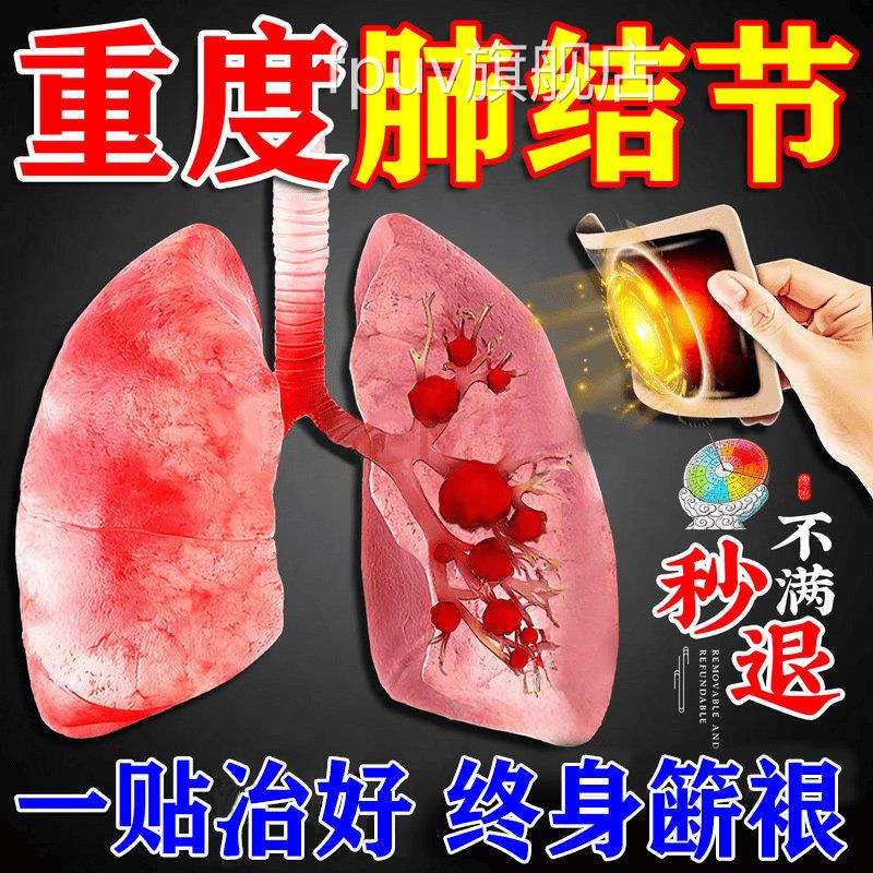 肺结节效特药槲皮素清肺散结节丸肺结节消除药的磨玻璃去小结节贴