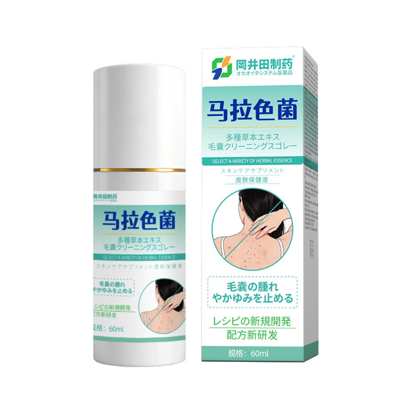 马拉色菌专用喷雾头胸背祛痘