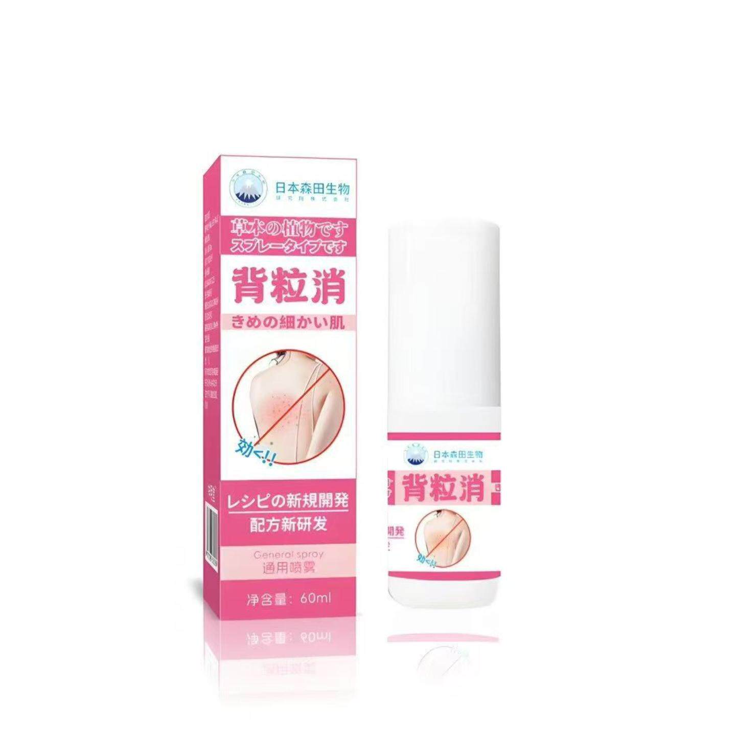 背粒消喷雾60ml专治胸前背部瘙痒