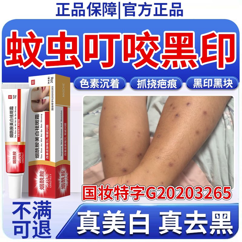 烟酰胺美白霜】蚊虫叮咬祛黑印