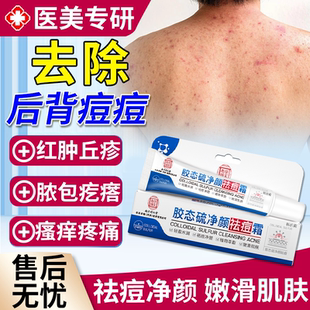 后背长痘痘去除毛囊炎马拉色菌前胸背上祛痘喷雾除螨痒背部背后QF