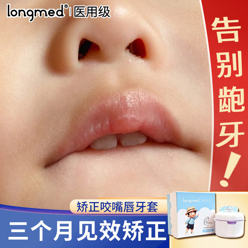 儿童宝宝防咬下嘴唇神器防吸吃咬手指上嘴凸深覆合矫正器夜间牙套