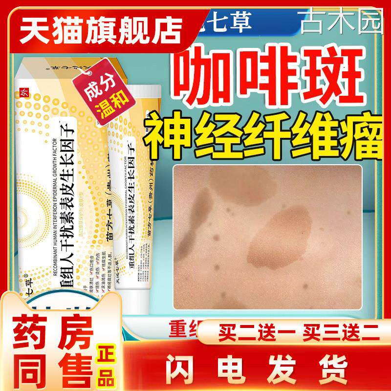 神经纤维瘤非药膏皮肤牛奶咖啡斑去除儿童胎记后背汗斑淡化斑点