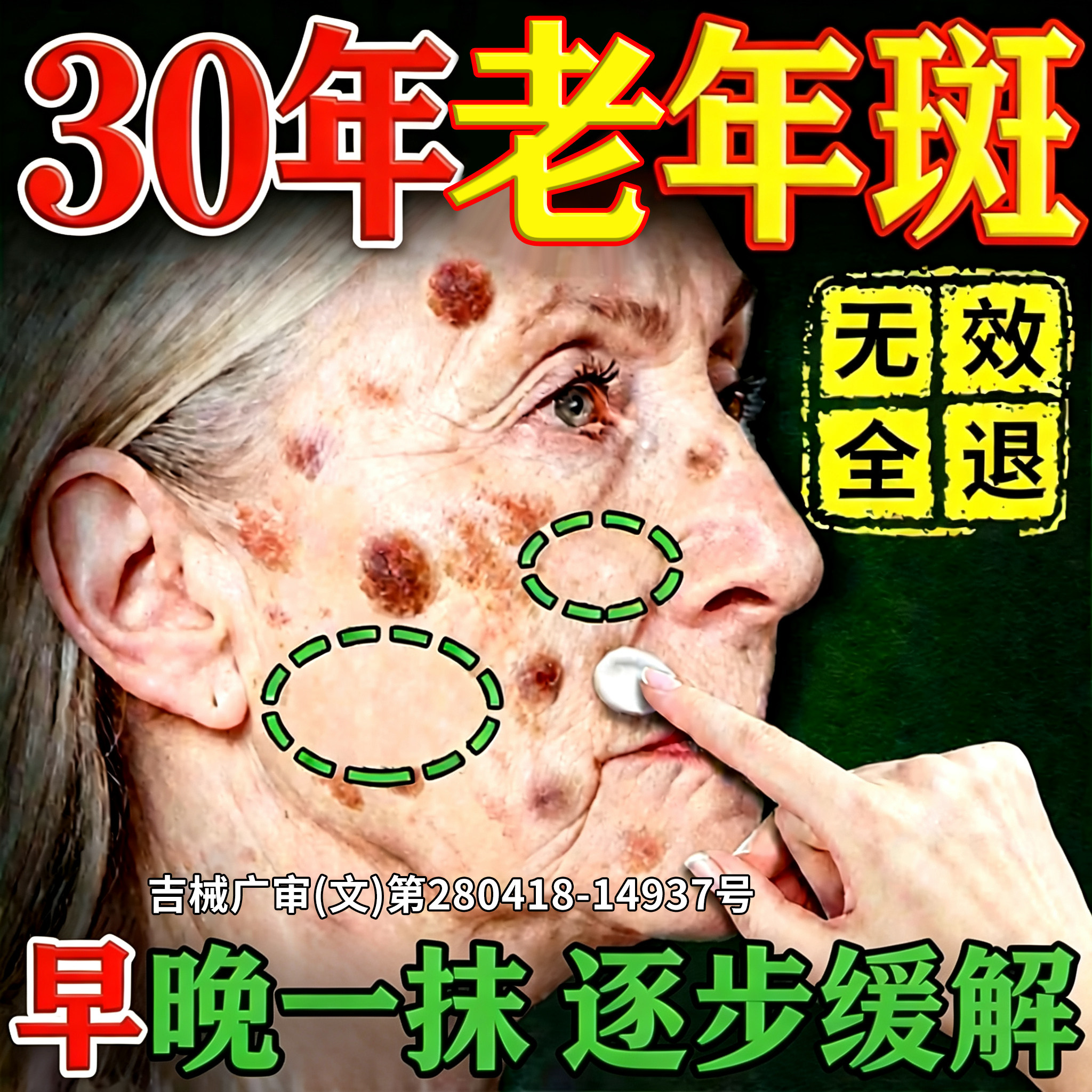 祛老年斑强力去除专用膏药手脸部祛黄褐斑雀斑霜效官方正品第一名