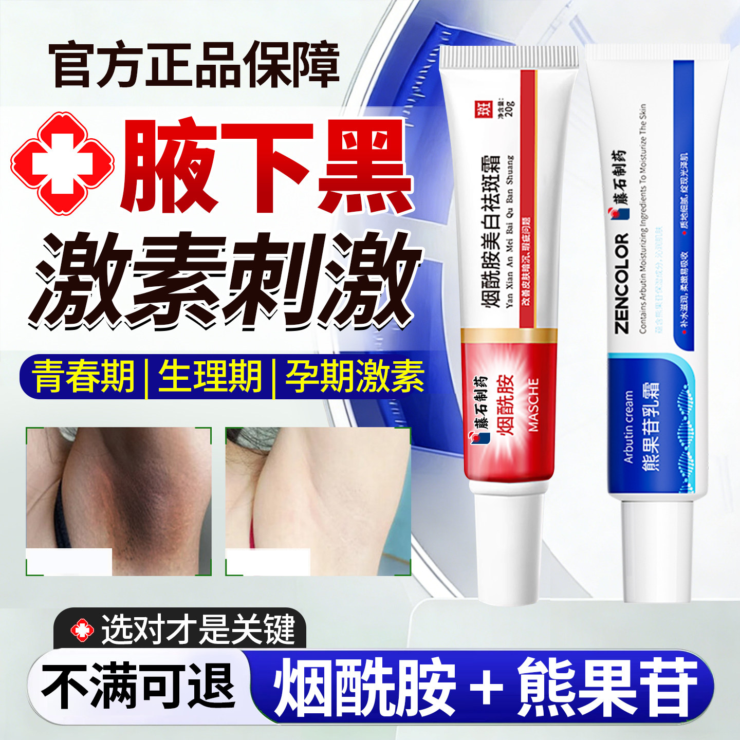 腋下黑色素沉淀黑腋窝咯吱窝烟酰胺美白乳膏黑棘皮除神器SE