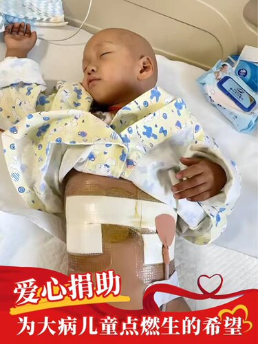 【慈善捐赠】阿里巴巴公益捐款大病儿童救助行动公益捐赠献爱心