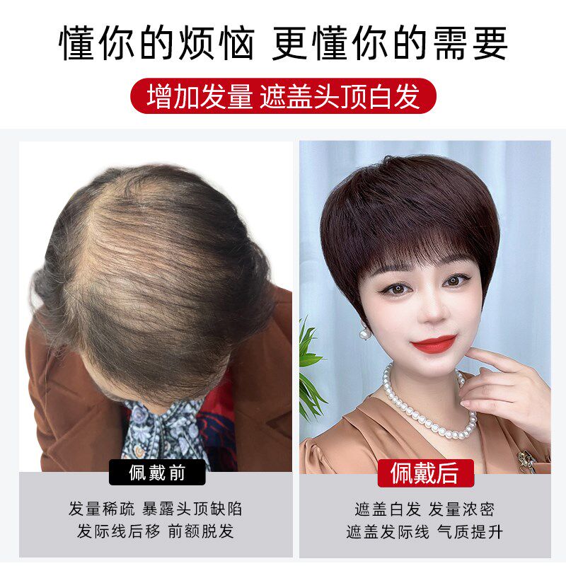 假发片女头顶补发片真发全真人发自然蓬松纹理烫发型遮白发增发量