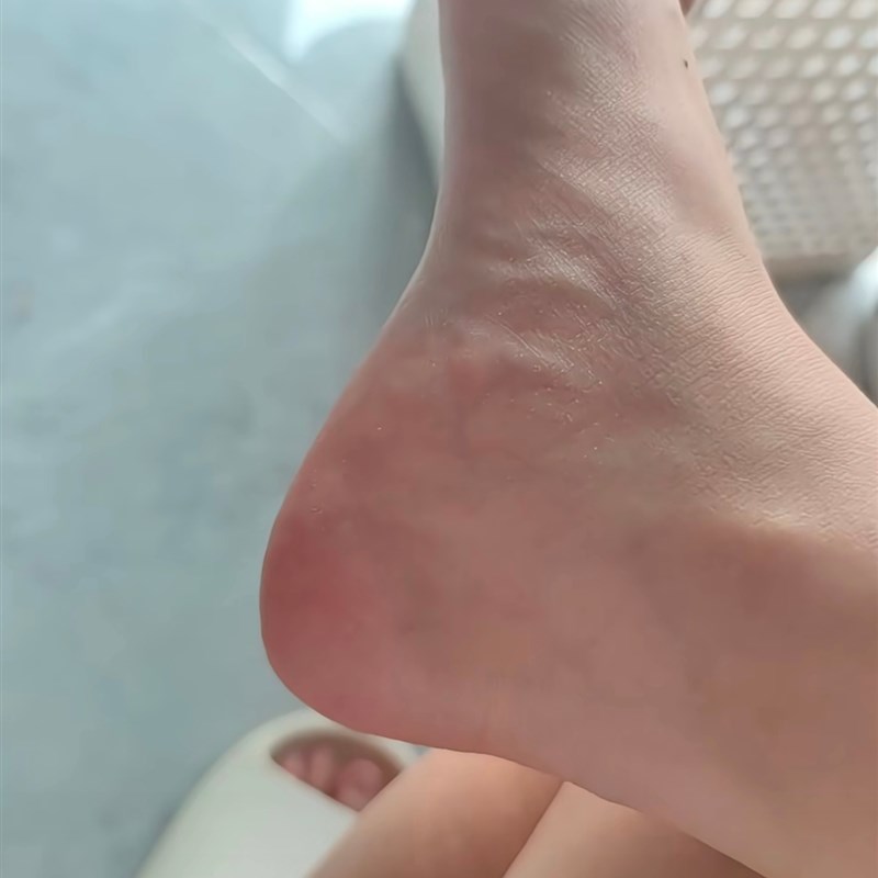 让我遇见介个好东西!搓脚神器磨脚去死皮老茧家用修脚搓脚板刮脚