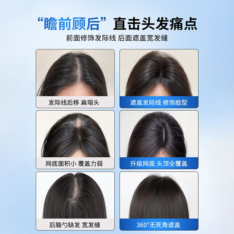 瑞家假发女片头顶真发辫子发增发量蓬松遮头顶白发自然前额假刘海
