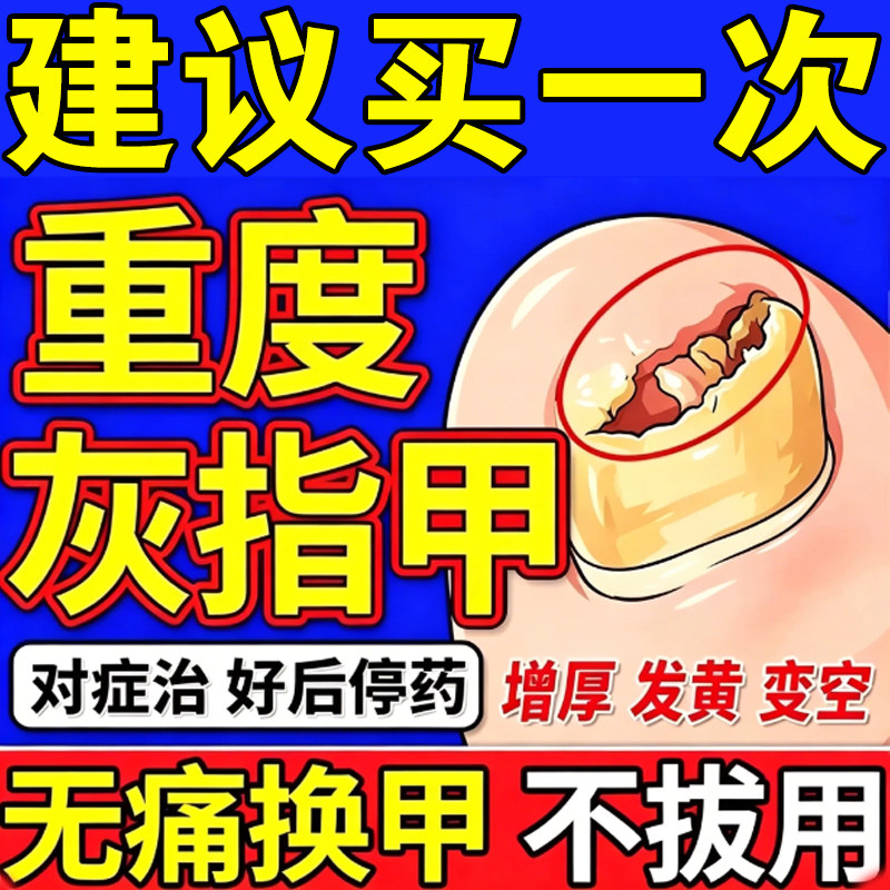 [金归]环吡酮胺乳膏1%*20g*1支/盒