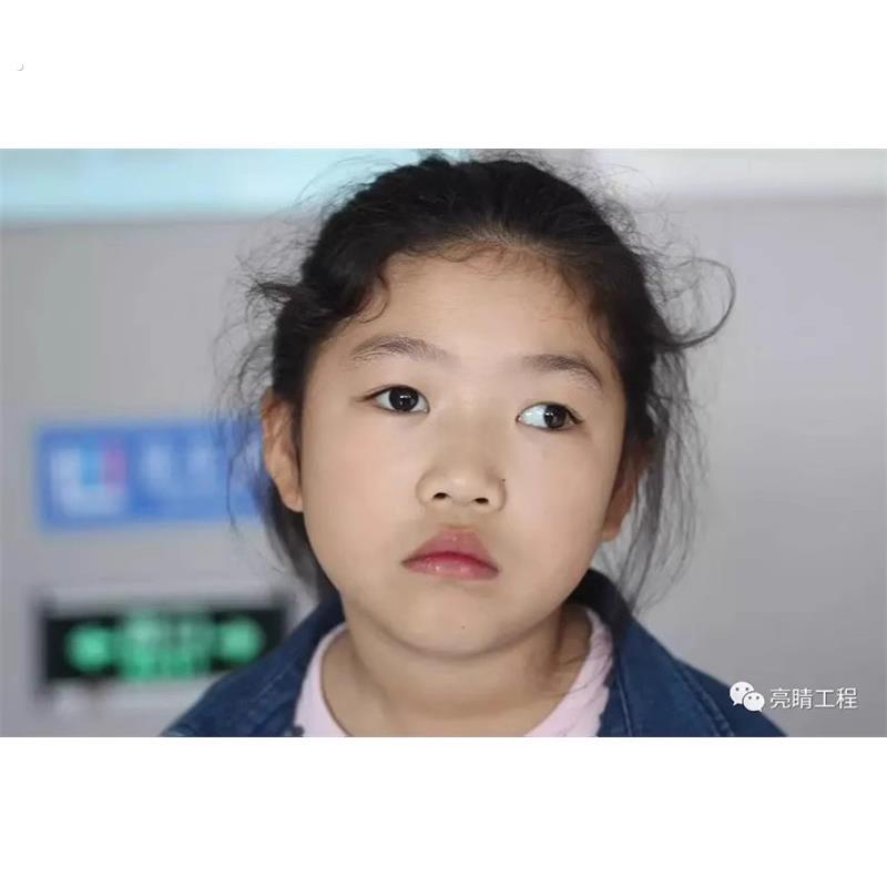 三棱镜近视压贴片三棱镜贴膜斜视眼镜压贴膜三棱镜贴片棱镜度数