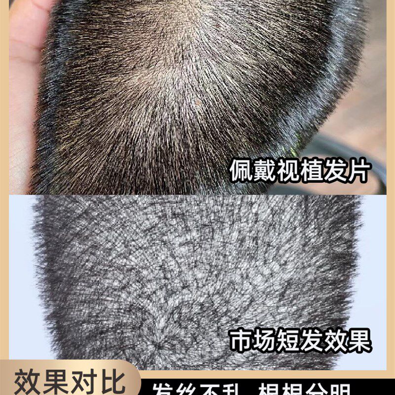 假发男光头假发短发全真人发植发郭德纲发型头顶生物头皮真发直发