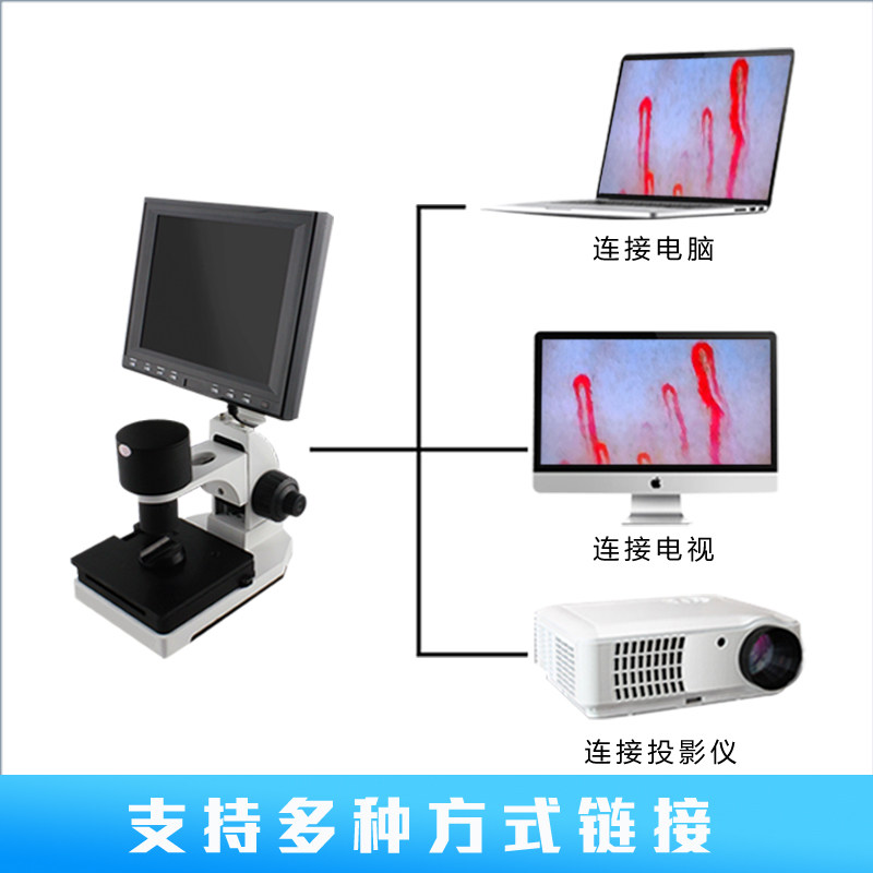 手指末梢血液流速观察仪甲襞微型循环检测仪高清测血液循环XW-880