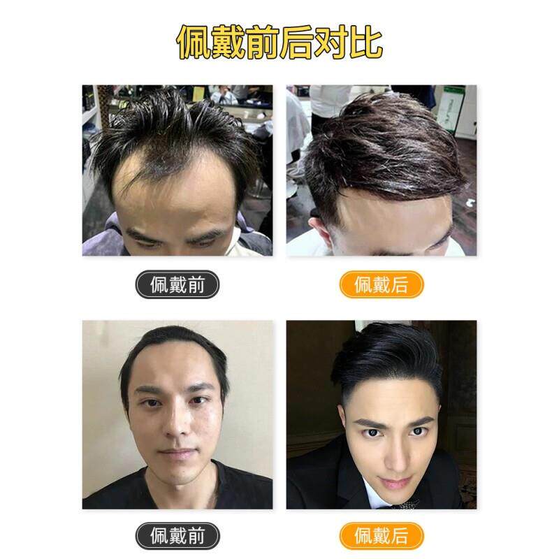 隐形发际线男士假发真人发超薄瑞士网蕾丝前额m型刘海补发片
