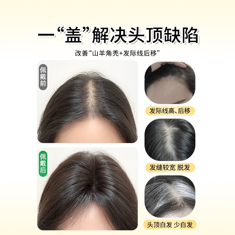 刘海假发片女头顶遮白发蓬松增发量自然真发高颅无痕顶递针补发片