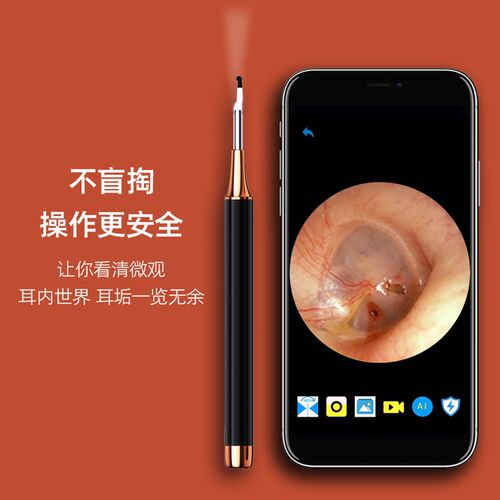 小鹿采耳工具专业可视化挖耳勺高清内窥镜儿童掏耳朵清洁神器套装