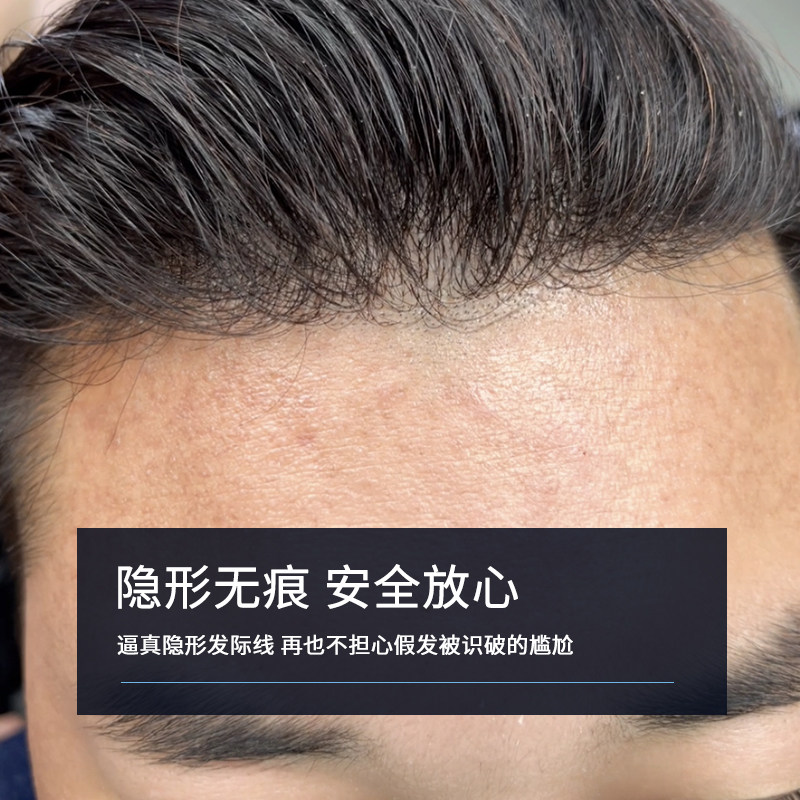 假发男式头顶补发递针全真发织发块秃顶前额发际线隐形无痕短毛寸
