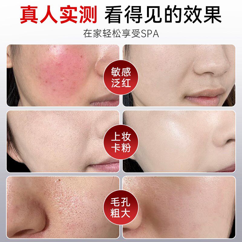 高压注氧仪纳米喷雾补水仪家用补水器便携式手持水氧仪导入水光仪