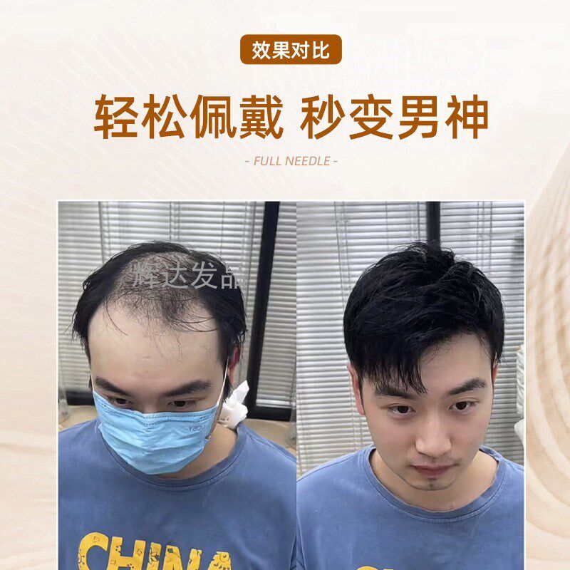 男士假发递针男短发前额补发片真发无痕全头套秃顶生物头皮补发块