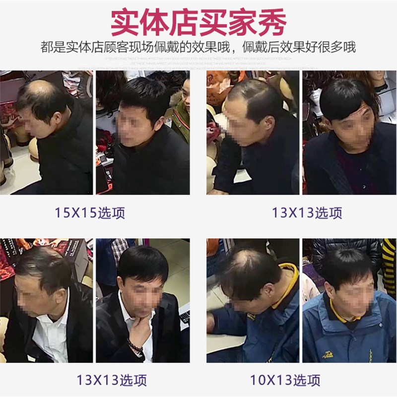 男短发发块手织真发补发假发头顶男士假发无痕隐形脱发地中海谢顶